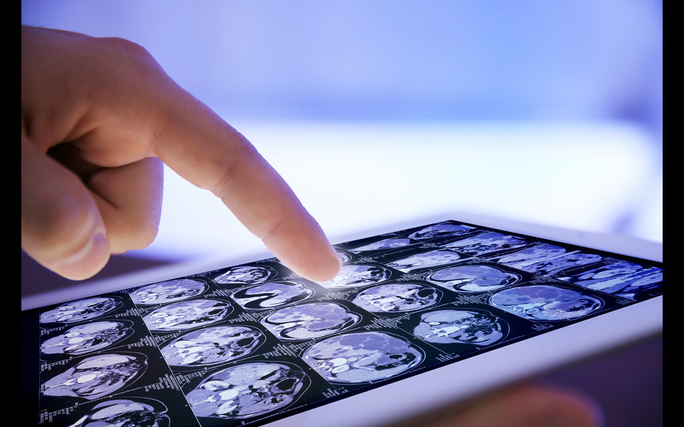 Keeping up with cyber risks in AI-powered healthcare wearables